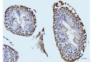 IHC analysis of SBNO1 using anti-SBNO1 antibody (ABIN7601710). (SBNO1 anticorps  (AA 43-1303))
