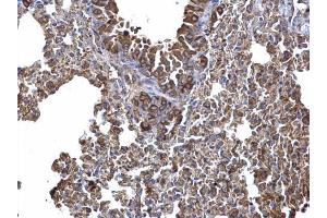 IHC-P Image AICDA antibody [N1N2], N-term detects AICDA protein at cytosol on mouse lymph node by immunohistochemical analysis.