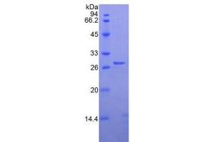 SDS-PAGE analysis of Human Elastase 3B Protein. (Elastase 3B Protéine)