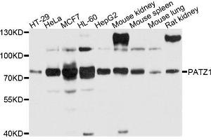 Western blot analysis of extracts of various cells, using PATZ1 antibody. (PATZ1 anticorps)