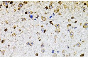 Immunohistochemistry of paraffin-embedded Mouse brain using ALDH1A1 Polyclonal Antibody at dilution of 1:100 (40x lens).