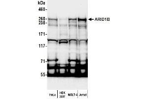 Western Blotting (WB) image for anti-AT Rich Interactive Domain 1B (SWI1-Like) (ARID1B) (AA 1300-1350) antibody (ABIN7454714)