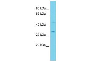 Host: Rabbit  Target Name: Acbd6  Sample Tissue: Rat Stomach lysates  Antibody Dilution: 1. (ACBD6 anticorps  (Middle Region))