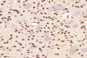 Immunohistochemistry analysis of paraffin-embedded mouse striatum using,PARC (ABIN7073606) at dilution of 1: 1200