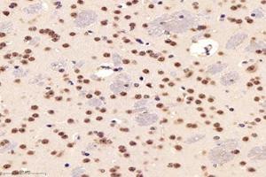 Immunohistochemistry analysis of paraffin-embedded mouse striatum using,PARC (ABIN7073606) at dilution of 1: 1200