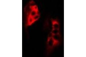 Immunofluorescent analysis of SCYL1 staining in MCF7 cells. (SCYL1 anticorps)