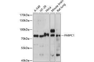 Western blot analysis of extracts of various cell lines, using P antibody (ABIN7269446) at 1:1000 dilution. (PABP anticorps  (AA 350-450))