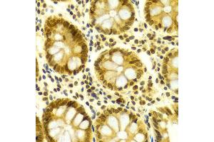 Immunohistochemistry of paraffin-embedded Human colon using ELAVL1 antibody at dilution of 1:100 (x400 lens).