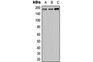 Western blot analysis of MRP2 expression in HeLa (A), mouse brain (B), H9C2 (C) whole cell lysates. (ABCC2 anticorps  (Center))