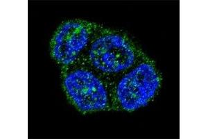 Confocal immunofluorescent analysis of FAS antibody with T47D cells followed by Alexa Fluor 488-conjugated goat anti-rabbit lgG (green).