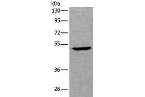 Western blot analysis of Human fetal liver tissue lysate using UMPS Polyclonal Antibody at dilution of 1:400 (UMPS anticorps)