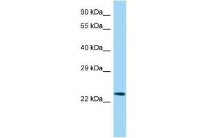 Host:  Rabbit  Target Name:  Etv3l  Sample Type:  Rat Spleen lysates  Antibody Dilution:  1. (ETV3L anticorps  (Middle Region))