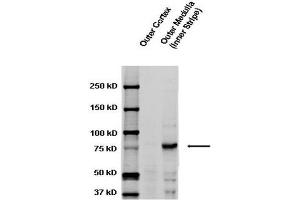 Western blot analysis of Rat kidney tissue lysates showing detection of ENaC protein using Rabbit Anti-ENaC Polyclonal Antibody . (SCNN1A anticorps  (AA 629-650) (Atto 488))