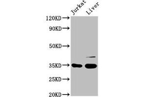 Western Blot Positive WB detected in: Jurkat whole cell lysate, Rat liver tissue All lanes: GAS2 antibody at 3. (GAS2 anticorps  (AA 1-141))