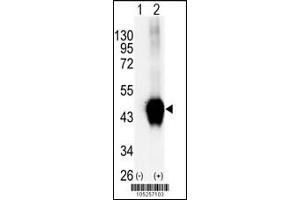 Western blot analysis of BCKDK using rabbit polyclonal. (BCKDK anticorps  (C-Term))