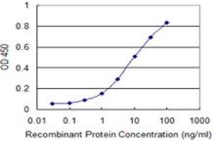 Detection limit for recombinant GST tagged RAD51 is 0.