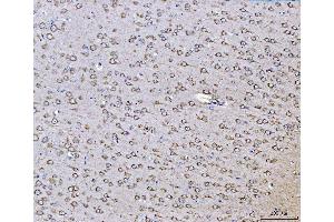 IHC analysis of PLD3 using anti-PLD3 antibody (ABIN7599439). (PLD3 anticorps  (AA 1-490))