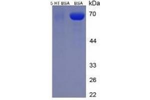 5-Hydroxytryptamine (5-HT) ELISA Kit