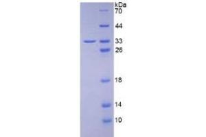 SDS-PAGE of Protein Standard from the Kit (Highly purified E. (C1QBP Kit ELISA)