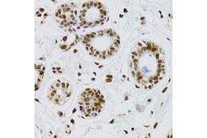 Immunohistochemistry of paraffin-embedded human breast using XRCC6 Antibody.