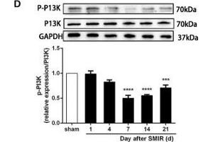 The CXCR7 and PI3K/Akt signaling pathways are involved in CPSP in the dorsal horn of the spinal cord. (GAPDH anticorps)