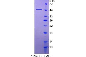 Image no. 1 for Platelet Derived Growth Factor D (PDGFD) (AA 19-370) protein (His tag) (ABIN6236936)