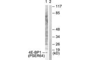 Western blot analysis of extracts from Jurkat cells treated with Insulin 0.