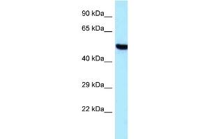 Western Blotting (WB) image for anti-threonyl-tRNA Synthetase 2, Mitochondrial (TARS2) (C-Term) antibody (ABIN2789298) (TARS2 anticorps  (C-Term))