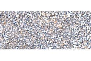 Immunohistochemistry of paraffin-embedded Human tonsil tissue using ITGA3 Polyclonal Antibody at dilution of 1:45(x200) (ITGA3 anticorps)