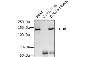Immunoprecipitation analysis of 300 μg extracts of Jurkat cells using 3 μg DDB1 antibody (ABIN1679509, ABIN5664466, ABIN5664468 and ABIN6220382). (DDB1 anticorps  (C-Term))