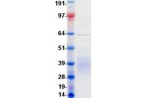 Validation with Western Blot