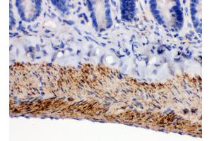 Anti- MAOB Picoband antibody,IHC(P) IHC(P): Rat Intestine Tissue