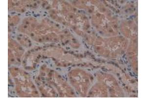 IHC-P analysis of Human Kidney Tissue, with DAB staining. (ATG7 anticorps  (AA 429-488))