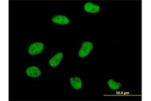 Immunofluorescence of purified MaxPab antibody to AOF2 on HeLa cell. (LSD1 anticorps  (AA 1-876))