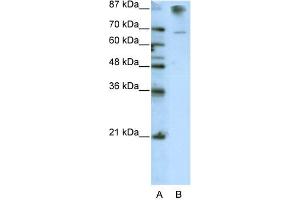 WB Suggested Anti-HKR1 Antibody Titration:  0. (HKR1 anticorps  (C-Term))