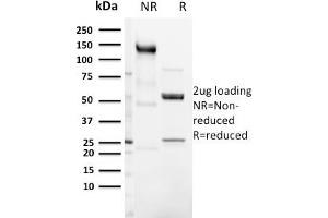 SDS-PAGE Analysis Purified CD3e Rabbit Recombinant Monoclonal Antibody (C3e/3125R). (Recombinant CD3 epsilon anticorps  (AA 23-119))
