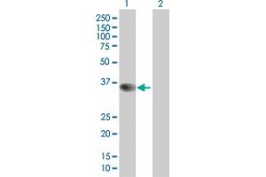 Lane 1: AKR1C3 transfected lysate ( 35. (AKR1C3 293T Cell Transient Overexpression Lysate(Denatured))