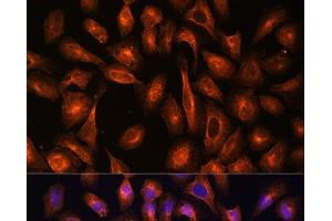 Immunofluorescence analysis of U-2 OS cells using SPTAN1 Polyclonal Antibody at dilution of 1:100.