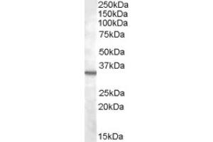 Image no. 1 for anti-Bradykinin Receptor B1 (BDKRB1) (Internal Region) antibody (ABIN375179) (BDKRB1 anticorps  (Internal Region))