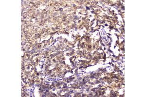 IHC analysis of 14-3-3 zeta/delta using anti-14-3-3 zeta/delta antibody . (14-3-3 zeta anticorps)