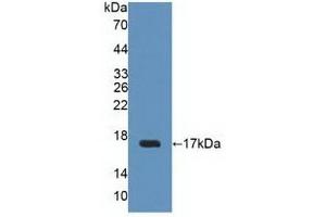 Detection of Recombinant UPK2, Human using Polyclonal Antibody to Uroplakin 2 (UPK2) (Uroplakin 2 anticorps  (AA 26-153))