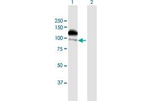 Western Blot analysis of ZFYVE16 expression in transfected 293T cell line by ZFYVE16 MaxPab polyclonal antibody. (ZFYVE16 anticorps  (AA 1-809))