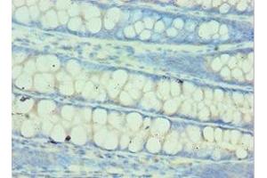 Immunohistochemistry of paraffin-embedded human colon tissue using ABIN7154026 at dilution of 1:100