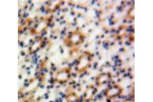 IHC-P analysis of Kidney tissue, with DAB staining. (Granulin anticorps  (AA 361-585))