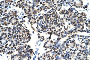 anti-Homeobox B5 (HOXB5) (N-Term) antibody