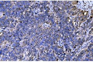 IHC analysis of ENAH/MENA using anti-ENAH/MENA antibody (ABIN7601316).