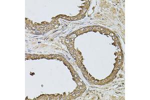 Immunohistochemistry of paraffin-embedded human prostate using ANXA8L2 antibody (ABIN5975720) at dilution of 1/100 (40x lens). (ANXA8L2 anticorps)