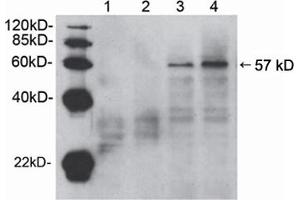 Western blot analysis of cell lysates from HEK-293 (lane 1 and 3) and NIH/3T3 (lane 2 and 4) cells,using Rabbit Anti-Akt (Ser473) Polyclonal Antibody (ABIN398622) . (AKT1 anticorps  (pSer473))
