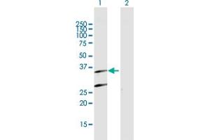 Western Blot analysis of PSMB7 expression in transfected 293T cell line by PSMB7 MaxPab polyclonal antibody. (PSMB7 anticorps  (AA 1-277))
