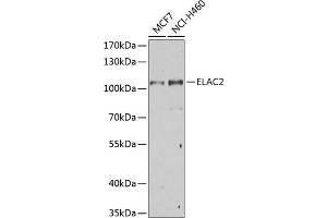 Western blot analysis of extracts of various cell lines, using EL Antibody (ABIN6132052, ABIN6140108, ABIN6140109 and ABIN6222942) at 1:1000 dilution. (ELAC2 anticorps  (AA 1-270))